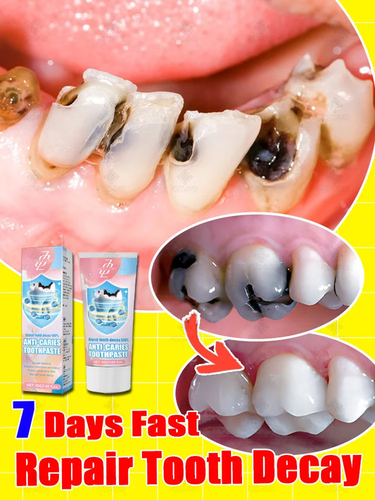 Rapid Cavity Repair Toothpaste – Effective Tooth Decay Treatment