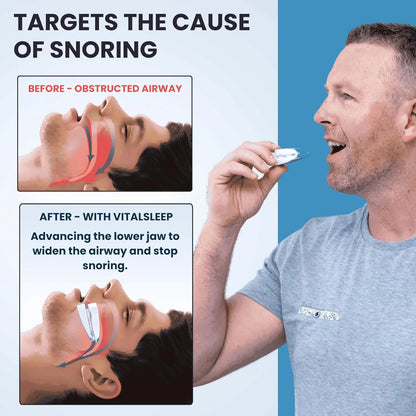 Adjustable Anti-Snoring Mouth Guard – Night Mouthpiece for Bruxism and Sleep Aid Snoring Relief