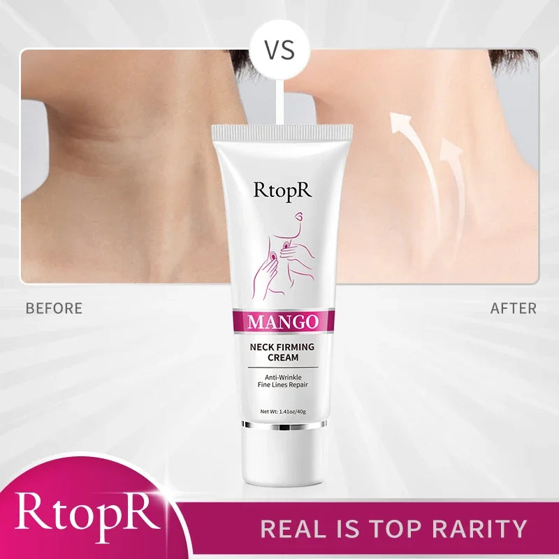 Rtopr Neck Cream — Reinforced Wrinkle Removal, Whitening & Moisturizing, Rejuvenating Neck Skincare