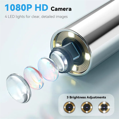 5-in-1 Smart Ear Camera with Screen – 1080P HD Earwax Removal Kit with Ear Picks, 6 Tips & 12 Extra Inspection Heads