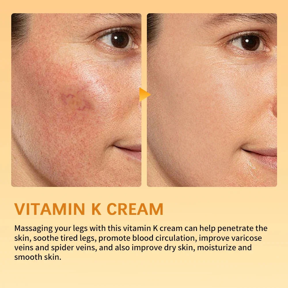 Vitamin K Leg Care Cream - Soothing Massage Cream for Tired Legs, Varicose Vein & Spider Vein Appearance Support