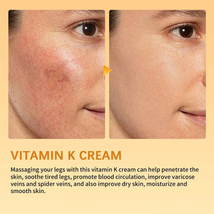 Vitamin K Leg Care Cream - Soothing Massage Cream for Tired Legs, Varicose Vein & Spider Vein Appearance Support