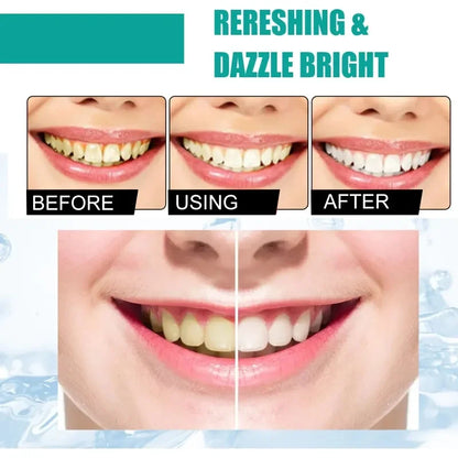 5 Day Teeth Whitening Powder – Removes Plaque & Stains, Deep Cleaning, Fresh Breath & Oral Hygiene Care