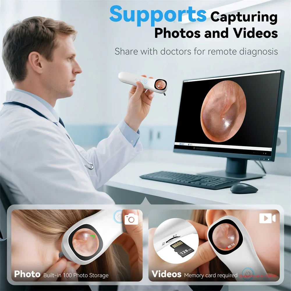5-in-1 Smart Ear Camera with Screen – 1080P HD Earwax Removal Kit with Ear Picks, 6 Tips & 12 Extra Inspection Heads