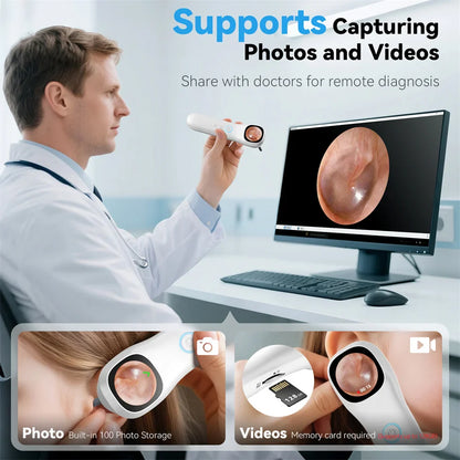 5-in-1 Smart Ear Camera with Screen – 1080P HD Earwax Removal Kit with Ear Picks, 6 Tips & 12 Extra Inspection Heads