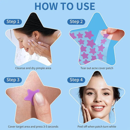 Colorful Star Pimple Patches – Invisible Acne Spot Stickers for Skin Care, Concealer & Makeup Tools