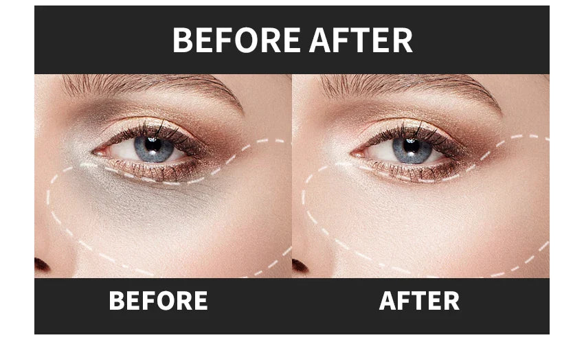 Micro-Needle Hyaluronic Acid Eye Patch – Anti-Wrinkle Moisturizing Eye Mask for Fine Lines Removal