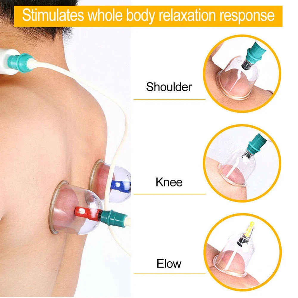 12/24-Cup Chinese Vacuum Cupping Therapy Set – Pull-Out Suction Massager for Pain Relief & Muscle Relaxation