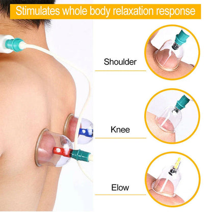 12/24-Cup Chinese Vacuum Cupping Therapy Set – Pull-Out Suction Massager for Pain Relief & Muscle Relaxation