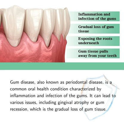 Oral Care Gum Repair Drops – Remove Yellow Stains & Support Periodontal Health