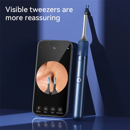 Visual Ear Cleaner with Camera – 12MP Ear Wax Removal Tool with Ear Pick, Tweezers & 6 Ear Spoons for Ear Care