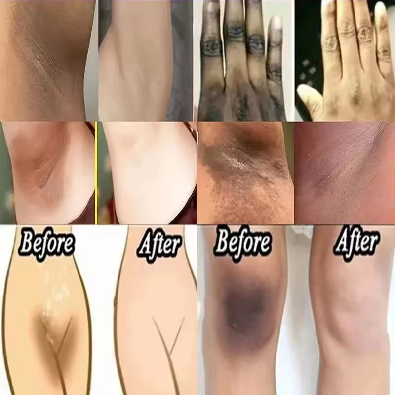 Whitening Body Cream for Underarm & Intimate Areas – Skin Brightening Moisturizer for Dark Skin Tone Care Korean Beauty Skincare Product