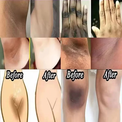 Whitening Body Cream for Underarm & Intimate Areas – Skin Brightening Moisturizer for Dark Skin Tone Care Korean Beauty Skincare Product