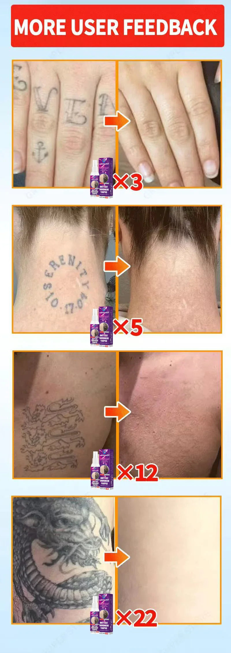 Tattoo Removal Spray — Fast-Acting Formula Removes Tattoos in 7 Days