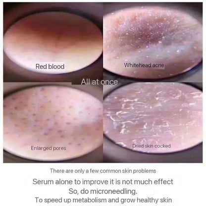 10pcs Sponge Microcrystal Freeze-Dried Collagen Powder — Natural Sponge Spicules for Skin Cell Renewal