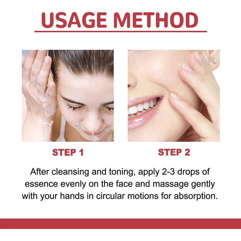 Niacinamide Serum – Dark Spot Correcting, Moisturizing & Brightening, Fades Fine Lines, Deep Cleansing Korean Skincare