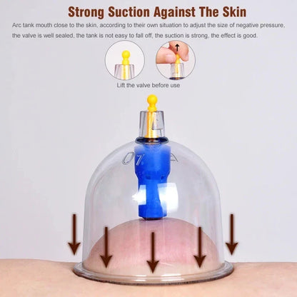 32PCS Professional Vacuum Cupping Set — Body Massager with Suction Cups for Relaxation, Detox & Anti-Cellulite Therapy