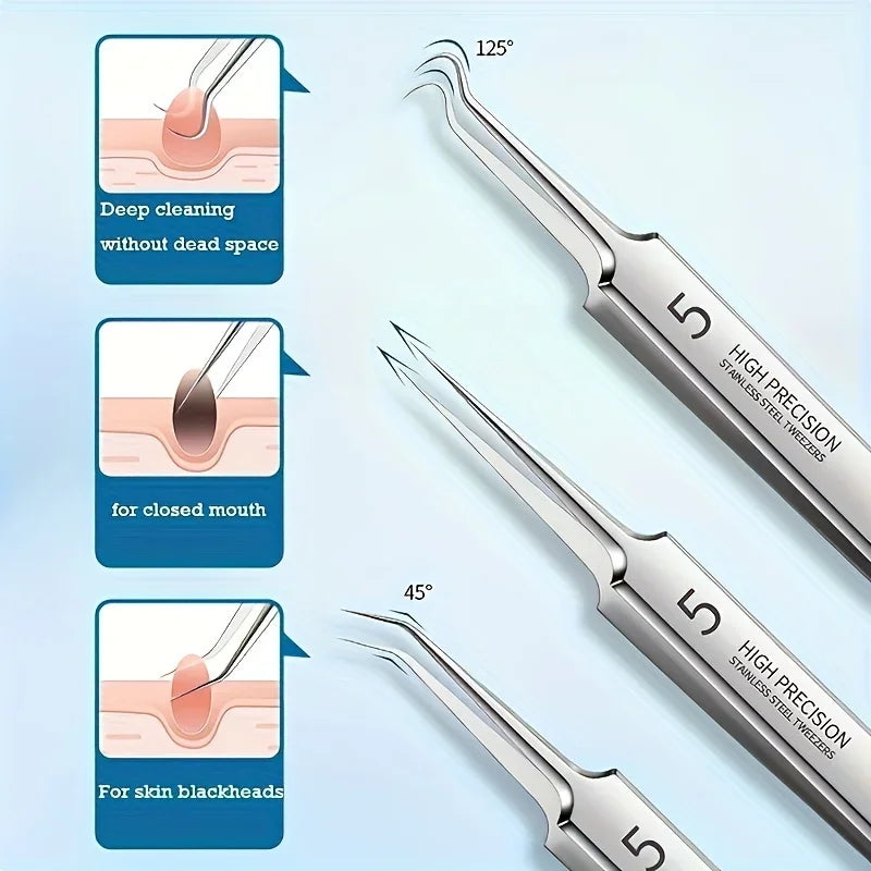 1/3/8PCS Stainless Steel Blackhead Removal Tool Set – Facial Tweezers, Acne Needles & Beauty Blackhead Removers