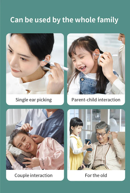 Smart Visual Ear Cleaner 1296P with Camera – USB-C Rechargeable Ear Wax Removal Tool, WiFi, 6 LED Lights