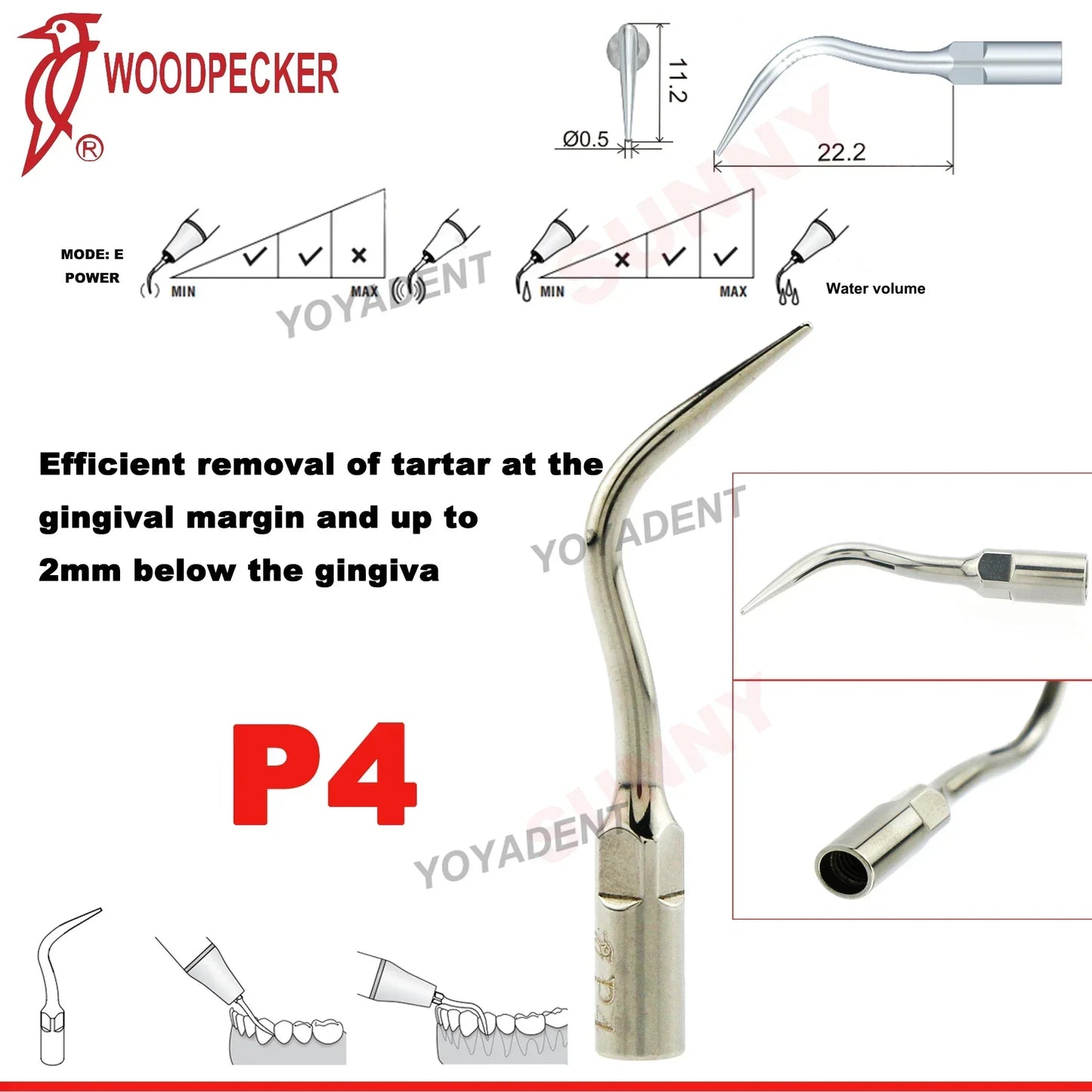 Woodpecker Dental Scaler Tips – Ultrasonic Tooth Cleaning, Endo & Perio Scaling Tips, Fit EMS UDS Scaler Handpiece