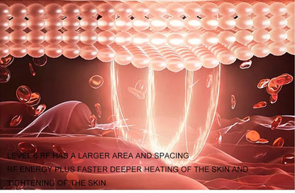 EMS Facial & Body RF Machine – Professional Radio Frequency Beauty Device for Skin Tightening, Face Lifting, and Anti-Aging Home Care