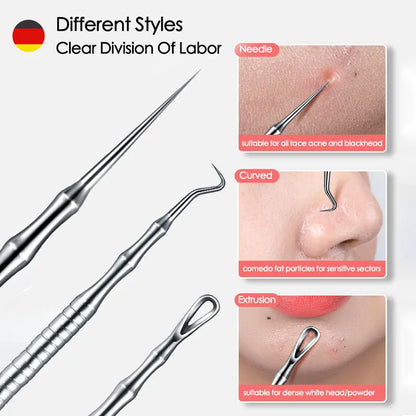 Blackhead Remover Acne Tool Kit – Pimple Extractor Needles, Tweezers & Deep Pore Cleaning Set