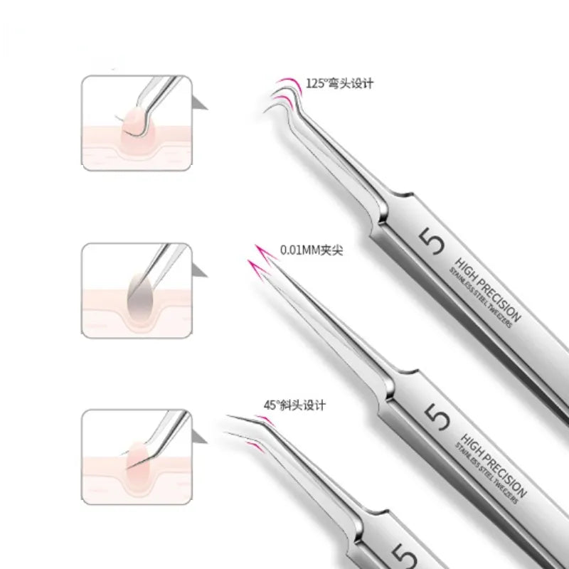 German Ultra-Fine No. 5 Cell Pimples Blackhead Clip Tweezers: Beauty Salon Special Scraping & Closing Tool