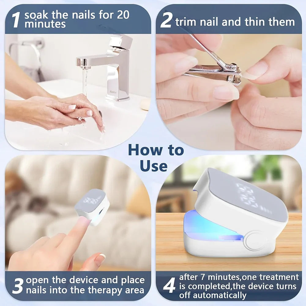 Nail Fungus Treatment Tools – Effective Anti-Fungal Equipment for Toenail & Nail Infection Removal