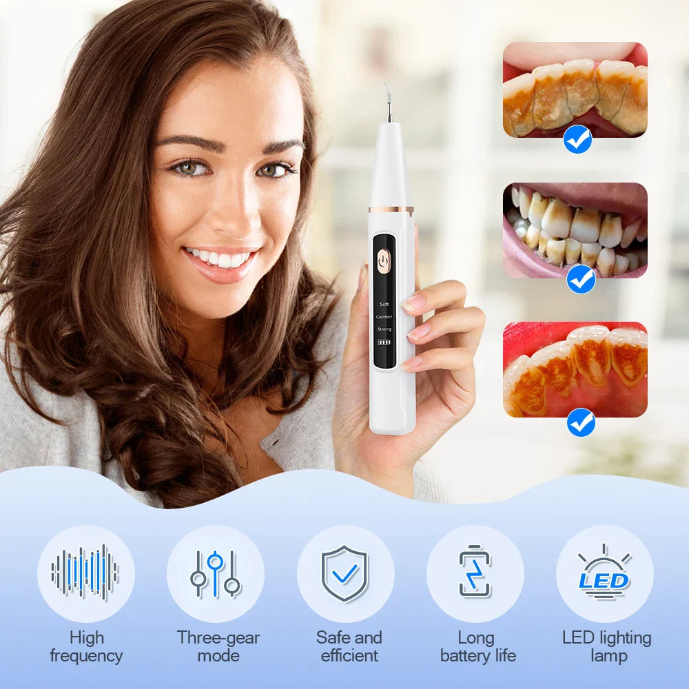 Ultrasonic Dental Scaler – Tartar Removal, Calculus Remover, Tooth Stain Cleaner with LED Light, Tooth Whitening Tools for Household Use