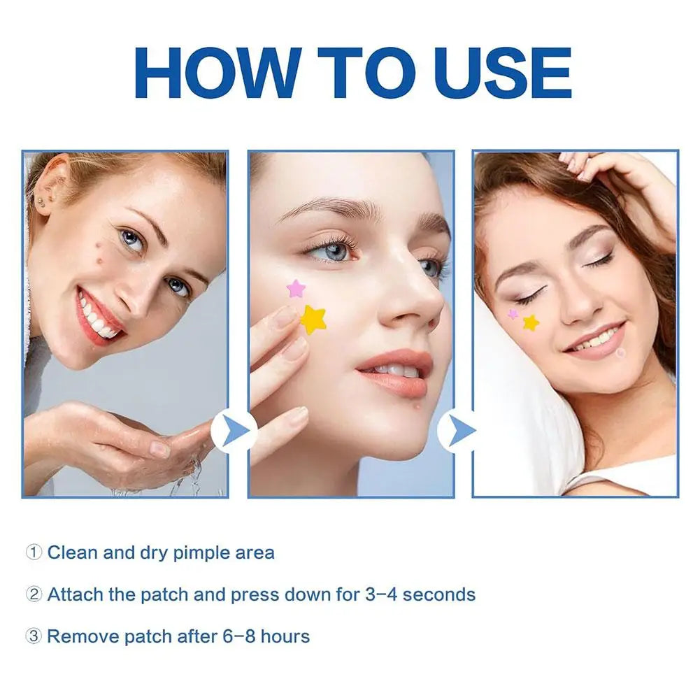 Colorful Star Pimple Patches – Invisible Acne Spot Stickers for Skin Care, Concealer & Makeup Tools