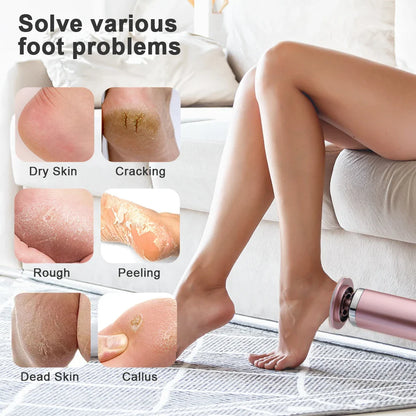 Rechargeable Wireless Electric Foot Callus Remover — Pedicure Tool for Dead Skin & Cuticle Removal (Replacement Sanding Heads)