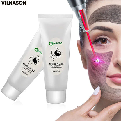 Carbon Cream Black Gel for ND YAG Laser – Skin Peeling, Rejuvenation, Whitening & Deep Cleansing Face Cream