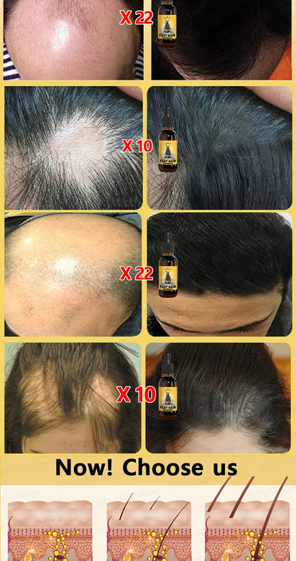 Rapid Hair Growth Serum – Beard, Chest & Body Hair Enhancer for Fuller, Thicker Growth