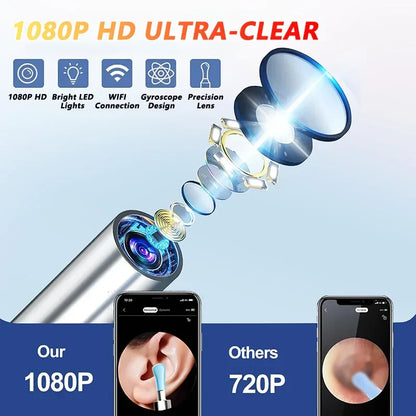 Visual Ear Wax Cleaner with Camera – Safe Luminous Otoscope Endoscope for Ear Cleaning & Ear Care