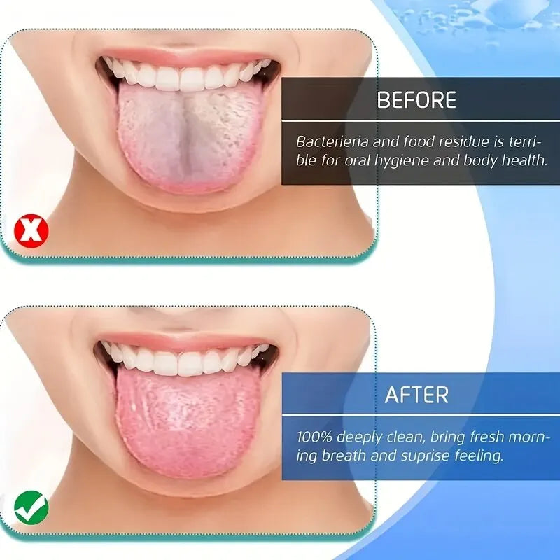 Stainless Steel U-shaped Tongue Scraper for Fresh Breath - 3 Color Options - Oral Hygiene Care Tool
