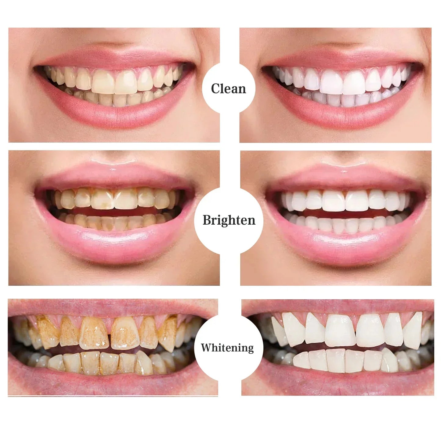 Teeth Whitening Toothpaste – Fruit Acid Formula for Plaque Removal, Stain & Calculus Cleanser, Fresh Breath & Oral Hygiene