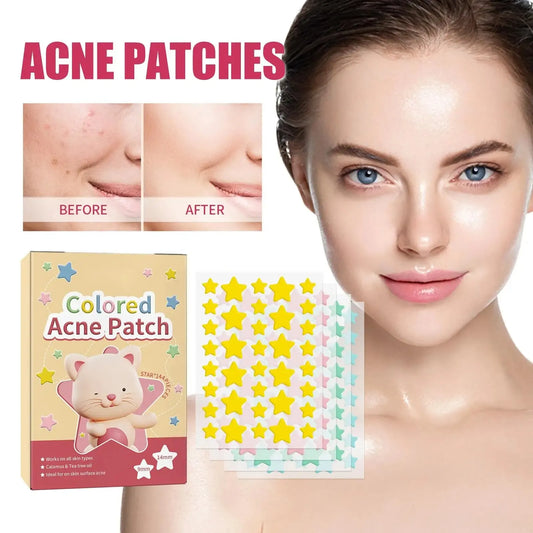 144PCS Star Acne Patches - Colorful Pentagram Design, Fade Pimple Marks & Clean Pores for Smooth Skin