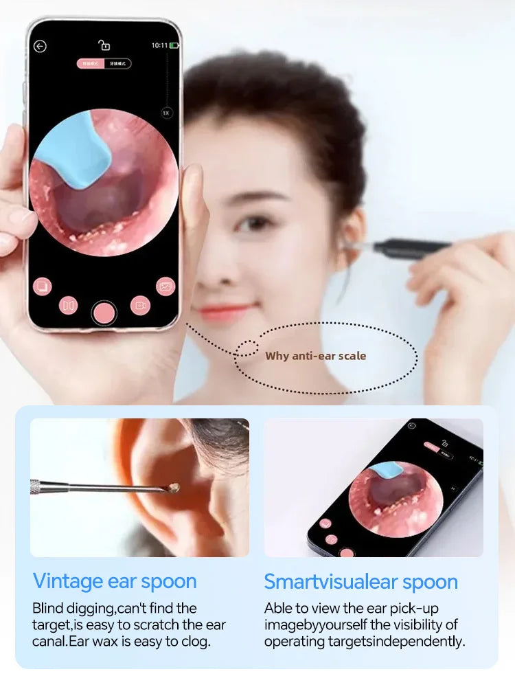 2025 Upgraded Visual Ear Wax Cleaner with Camera – Safe Earwax Removal Endoscope Tool with 5MP HD for Ear Care