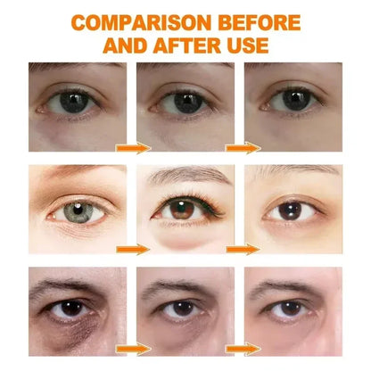 Anti-Dark Circle Eye Serum — Retinol Oil for Wrinkle Removal, Firming, Eye Bag Reduction, Fine Line Fading & Brightening Korean Eye Care