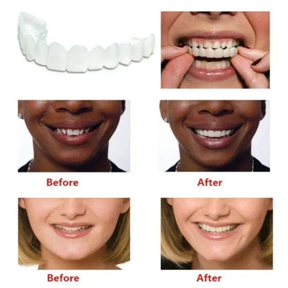 Perfect Fit Teeth Whitening Fake Tooth Cover – Snap-On Silicone Smile Veneers for Upper Teeth, Reusable Cosmetic Tool