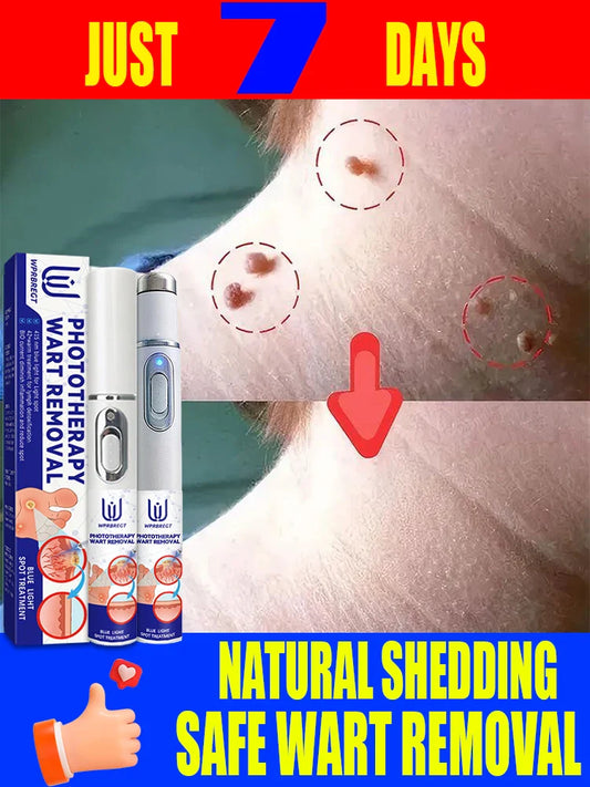 Safe Skin-Friendly Wart Removal Methods – Gentle Solutions for Effective Wart Treatment