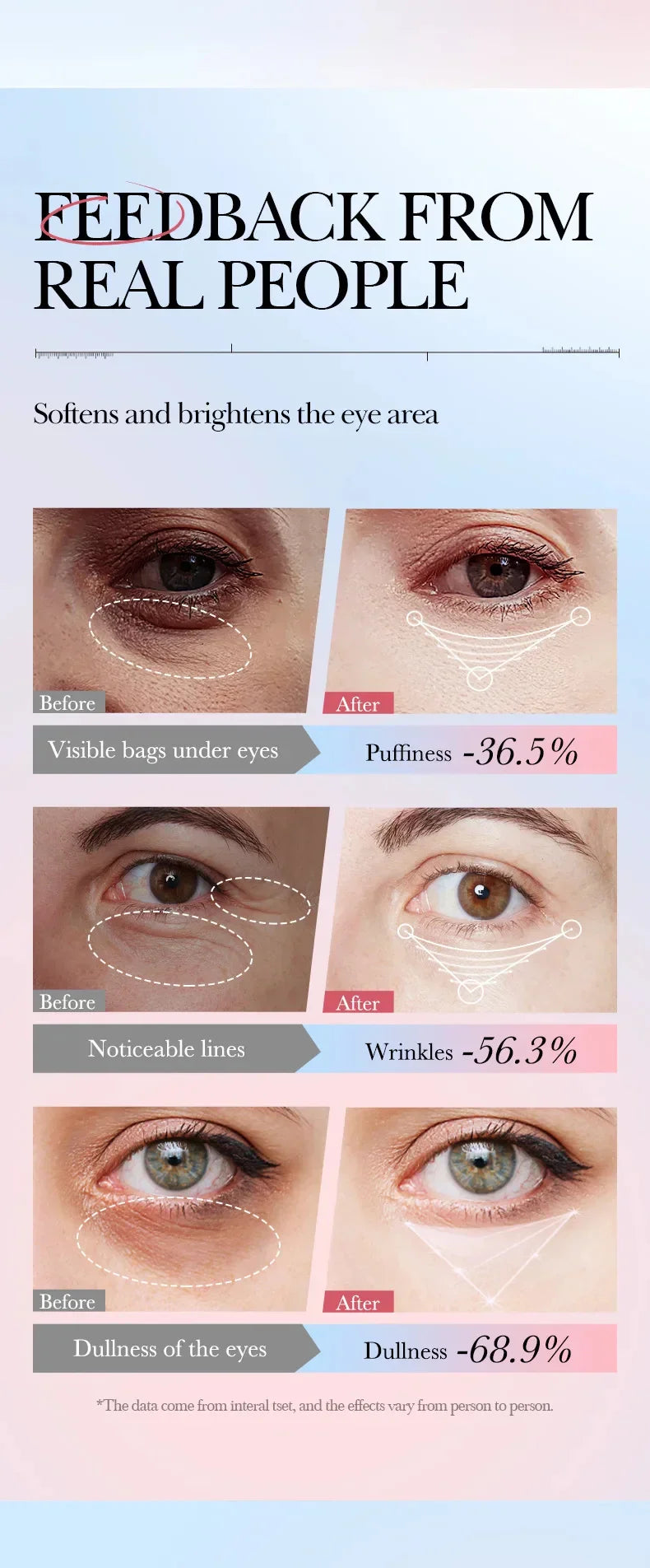 Instant Eye Bag Removal Cream – Collagen, Anti-Wrinkle, Dark Circle & Puffiness Treatment for Firming and Brightening