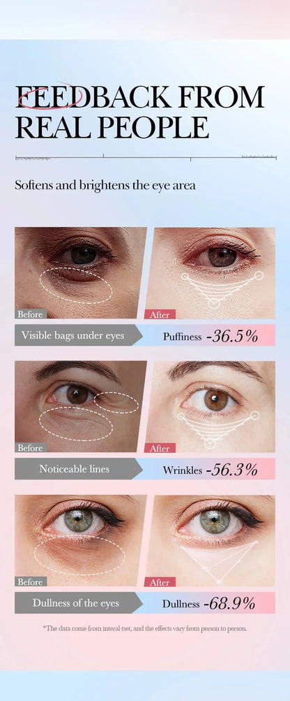Instant Eye Bag Removal Cream – Collagen, Anti-Wrinkle, Dark Circle & Puffiness Treatment for Firming and Brightening