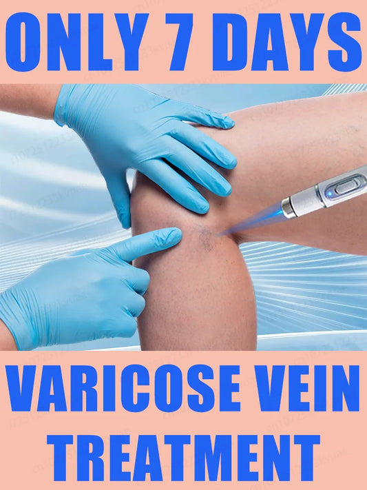 Medical-Grade Laser Treatment for Varicose & Spider Veins – Painless Leg Vein Therapy Equipment