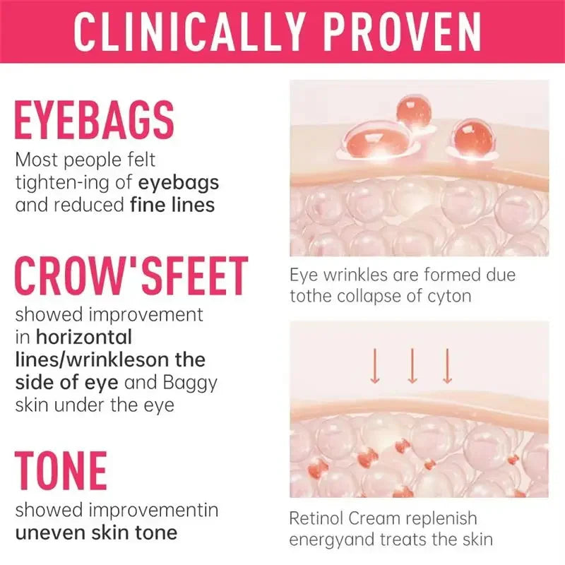 Instant Eye Bag Removal Cream – Collagen, Anti-Wrinkle, Dark Circle & Puffiness Treatment for Firming and Brightening