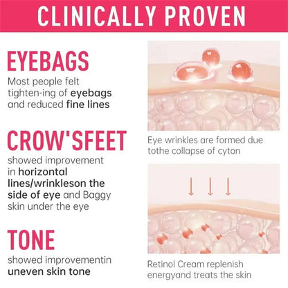 Instant Eye Bag Removal Cream – Collagen, Anti-Wrinkle, Dark Circle & Puffiness Treatment for Firming and Brightening