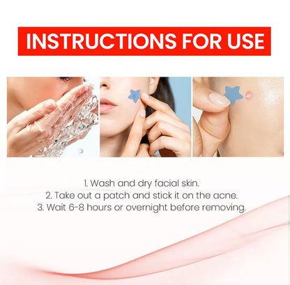 Acne Repair Patch - Facial Skin Care for Blemish & Pimple Marks, Acne Treatment & Pimple Repair Cover