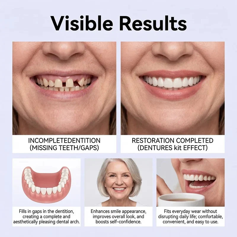 Adult Full Denture Set - Soft Silicone Upper & Lower Cosmetic Teeth for Natural-Looking Smile