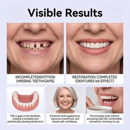Adult Full Denture Set - Soft Silicone Upper & Lower Cosmetic Teeth for Natural-Looking Smile