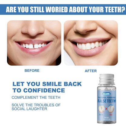 Resin False Teeth & Solid Gums — Temporary Filling Material for Dentistry, Oral Care, Denture Restoration 20/30ml